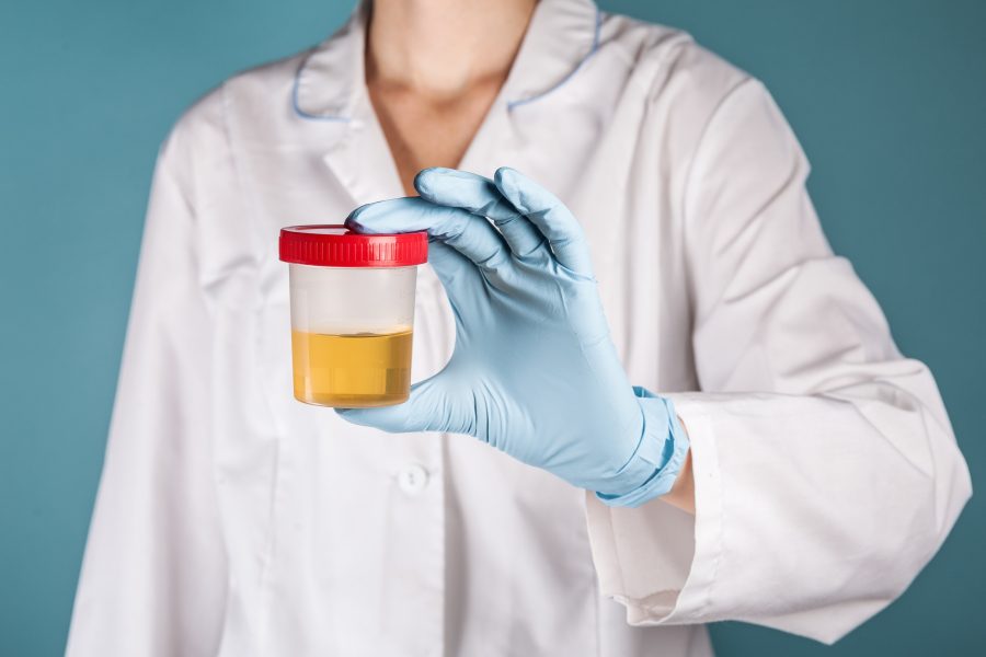 Nieuwe RTA microscopische hematurie: uniforme en doelmatige diagnostiek in de regio